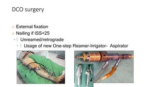 DCO surgery
 External fixation
 Nailing if ISS<25
• 🞑 Unreamed/retrograde
• 🞑 Usage of new One-step Reamer-Irrigator- Aspirator
 