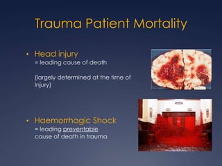 Trauma Patient Mortality
• Head injury
= leading cause of death
(largely determined at the time of
Injury)
• Haemorrhagic Shock
= leading preventable
cause of death in trauma
 