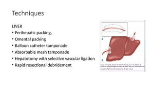 Comprehensive Overview of Damage Control Surgery: Techniques, Stages ...