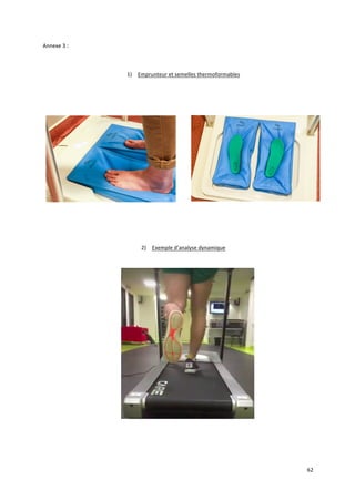 62	
Annexe	3	:	
	
1) Emprunteur	et	semelles	thermoformables	
	
	
	
	
	
	
2) Exemple	d’analyse	dynamique	
	
	
	
	
 