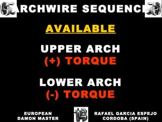 AVAILABLE
UPPER ARCH
(+) TORQUE
LOWER ARCH
(-) TORQUE
RAFAEL GARCIA ESPEJO
CORDOBA (SPAIN)
EUROPEAN
DAMON MASTER
ARCHWIRE SEQUENCE
 