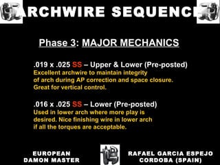 Phase 3: MAJOR MECHANICS
.019 x .025 SS – Upper & Lower (Pre-posted)
Excellent archwire to maintain integrity
of arch during AP correction and space closure.
Great for vertical control.
.016 x .025 SS – Lower (Pre-posted)
Used in lower arch where more play is
desired. Nice finishing wire in lower arch
if all the torques are acceptable.
RAFAEL GARCIA ESPEJO
CORDOBA (SPAIN)
EUROPEAN
DAMON MASTER
ARCHWIRE SEQUENCE
 