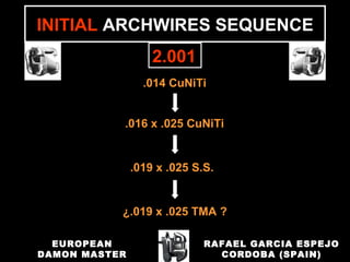 .014 CuNiTi
.016 x .025 CuNiTi
.019 x .025 S.S.
¿.019 x .025 TMA ?
INITIAL ARCHWIRES SEQUENCE
2.001
RAFAEL GARCIA ESPEJO
CORDOBA (SPAIN)
EUROPEAN
DAMON MASTER
 