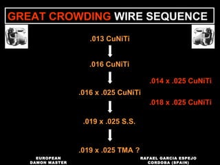 .013 CuNiTi
.016 CuNiTi
.016 x .025 CuNiTi
.019 x .025 S.S.
.019 x .025 TMA ?
GREAT CROWDING WIRE SEQUENCE
.014 x .025 CuNiTi
.018 x .025 CuNiTi
RAFAEL GARCIA ESPEJO
CORDOBA (SPAIN)
EUROPEAN
DAMON MASTER
 