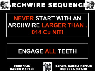 ENGAGE ALL TEETH
NEVER START WITH AN
ARCHWIRE LARGER THAN .
014 Cu NiTi
RAFAEL GARCIA ESPEJO
CORDOBA (SPAIN)
EUROPEAN
DAMON MASTER
ARCHWIRE SEQUENCE
 