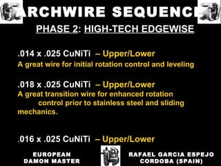 PHASE 2: HIGH-TECH EDGEWISE
.014 x .025 CuNiTi – Upper/Lower
A great wire for initial rotation control and leveling
.018 x .025 CuNiTi – Upper/Lower
A great transition wire for enhanced rotation
control prior to stainless steel and sliding
mechanics.
.016 x .025 CuNiTi – Upper/Lower
RAFAEL GARCIA ESPEJO
CORDOBA (SPAIN)
EUROPEAN
DAMON MASTER
ARCHWIRE SEQUENCE
 