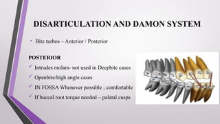 DAMON’S SYSTEM and its application in orthodontics | PPTX
