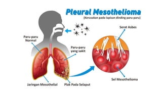 Dampak Penggunaan Material Asbes pada Hunian dan Bangunan.pptx