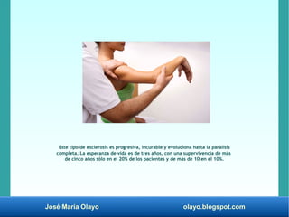 José María Olayo olayo.blogspot.com
Este tipo de esclerosis es progresiva, incurable y evoluciona hasta la parálisis
compl...