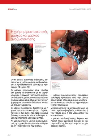 DAN Basic Life Support3232
Ενοτητα 5 | ΑΝΑΖΩΟΓΟΝΗΣΗ - ΚΑΡΠΑ
5.9 Η χρήση προστατευτικής
μάσκας και μάσκας
αναζωογόνησης
Όταν δίνετε αναπνοές διάσωσης, συ-
στήνεται η χρήση μάσκας αναζωογόνη-
σης ή προστατευτικής μάσκας ως προ-
στασία (Φιγούρα 26).
Οι μάσκες προστασίας είναι εύκολες
στη χρήση και διατίθενται με τη μορφή
μπρελόκ. Η τεχνική χορήγησης αναπνο-
ών διάσωσης χρησιμοποιώντας προστα-
τευτική μάσκα είναι ίδια με την τεχνική
χορήγησης αναπνοών διάσωσης (στόμα
με στόμα) χωρίς αυτή.
Οι μάσκες προστασίας διατίθενται με ή
χωρίς προστατευτικό φίλτρο. Παρόλο
που και οι δύο τύποι προσφέρουν μόνο
βασική προστασία, είναι καλύτερο να
χρησιμοποιήσετε μάσκα με φίλτρο.
Αν χρησιμοποιείτε μάσκα αναζωογόνη-
σης, η τεχνική διαφοροποιείται (Φιγού-
ρα 27 - περιγράφεται παρακάτω).
Η μάσκα αναζωογόνησης προσφέρει
καλύτερη προστασία από την μάσκα
προστασίας, αλλά είναι πολύ μεγαλύτε-
ρη και λιγότερο εύκολο να τη μεταφέρε-
τε στην τσέπη σας.
Μπορεί ωστόσο να μεταφερθεί μαζί με
το σετ πρώτων βοηθειών, στο σακίδια ή
την τσάντα σας, ή στο ντουλαπάκι του
αυτοκινήτου.
Η μάσκα αναζωογόνησης λέγεται και
Pocket Mask (εμπορικό όνομα), αν και
το μέγεθός της δεν της επιτρέπει να χω-
ρέσει σε τσέπες.
Φιγούρα 27:
Αναζωογόνηση
με τη χρήση
ρινοστοματικής
μάσκας
αναζωογόνησης
27
Φιγούρα 26:
Συστήνεται η χρήση
προστατευτικού
μέσου κατά
τη χορήγηση
αναπνοών
διάσωσης
26
 