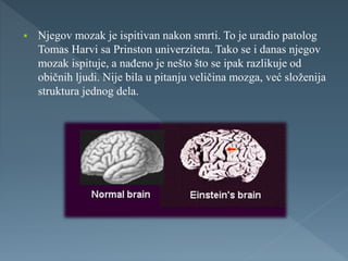  Njegov mozak je ispitivan nakon smrti. To je uradio patolog
Tomas Harvi sa Prinston univerziteta. Tako se i danas njegov
mozak ispituje, a nađeno je nešto što se ipak razlikuje od
običnih ljudi. Nije bila u pitanju veličina mozga, već složenija
struktura jednog dela.
 