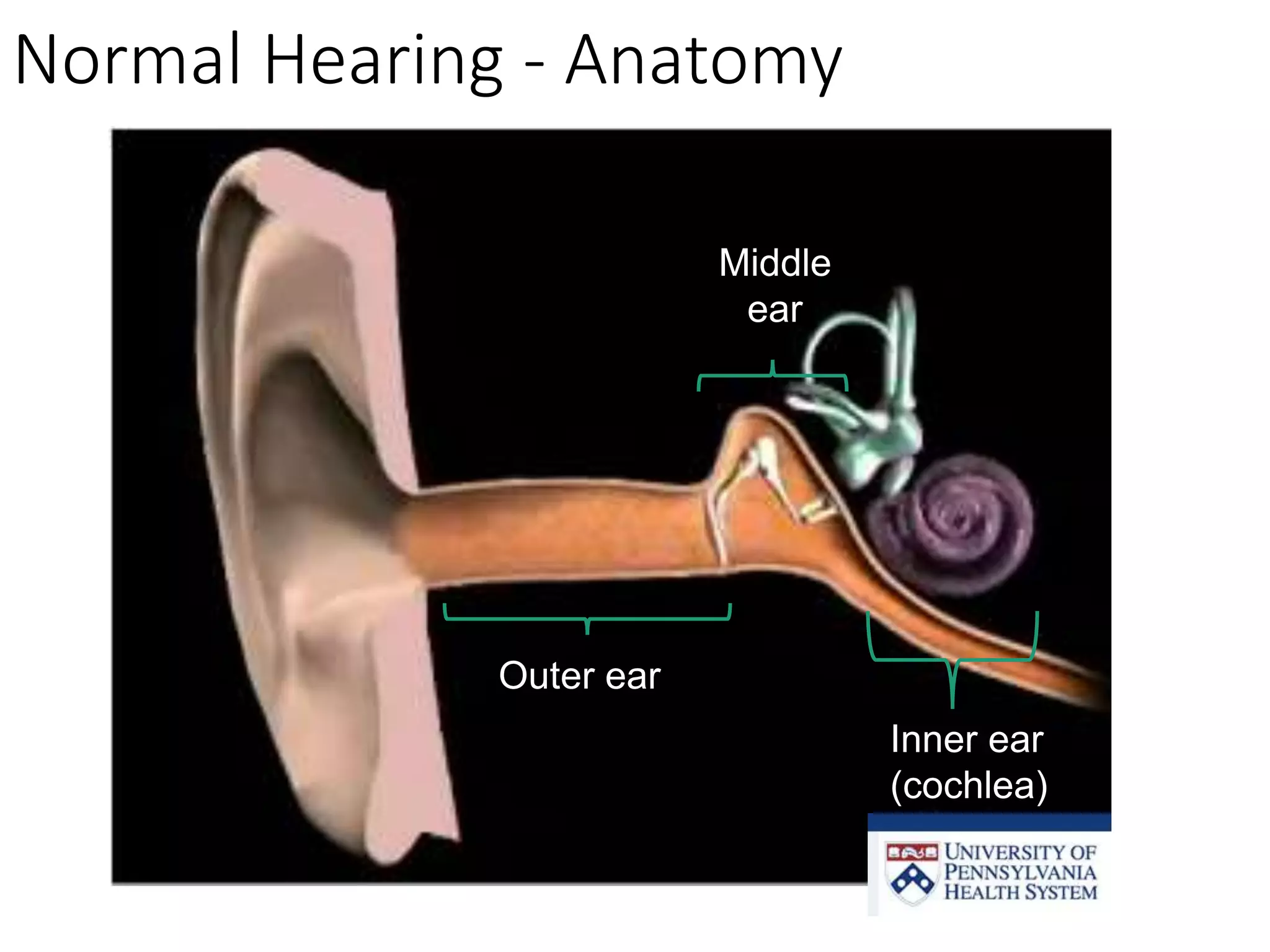 Auditory & Developmental Neurophysiology: Cochlear Implants seminar | PPTX