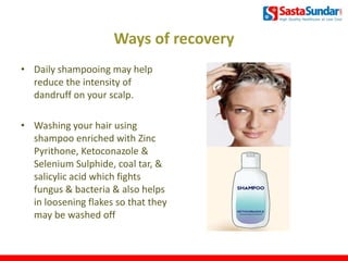 Ways of recovery
• Daily shampooing may help
reduce the intensity of
dandruff on your scalp.
• Washing your hair using
shampoo enriched with Zinc
Pyrithone, Ketoconazole &
Selenium Sulphide, coal tar, &
salicylic acid which fights
fungus & bacteria & also helps
in loosening flakes so that they
may be washed off
7
 