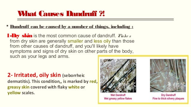 Dandruff