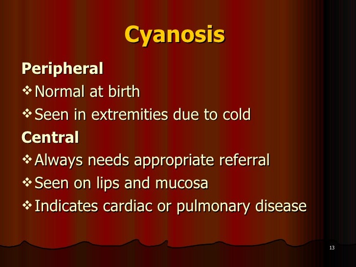 Danger signs in newborns