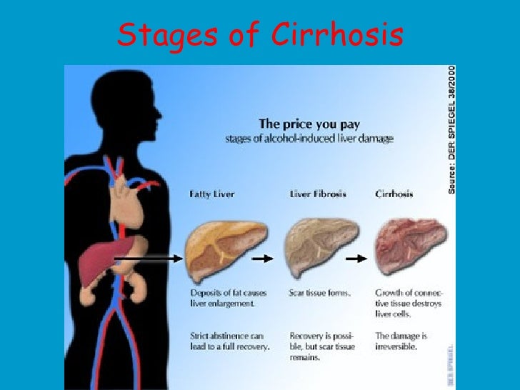 Stage 4 Lung Cancer How Long To Live CancerOz