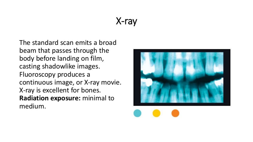 Dangers of ct scans and x rays