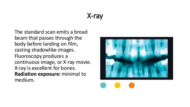 Dangers of ct scans and x rays