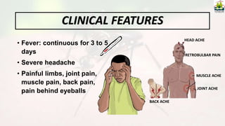 • Fever: continuous for 3 to 5
days
• Severe headache
• Painful limbs, joint pain,
muscle pain, back pain,
pain behind eyeballs
HEAD ACHE
MUSCLE ACHE
JOINT ACHE
BACK ACHE
CLINICAL FEATURES
RETROBULBAR PAIN
 