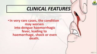 CLINICAL FEATURES
 