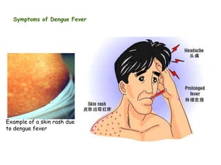 Symptoms of Dengue Fever

Example of a skin rash due
to dengue fever

 