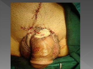 Dani apresenta HPV sintomas e prevenções 