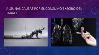 ALGUNAS CAUSAS POR EL CONSUMO EXECIBO DEL
TABACO
 