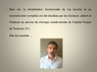 • Bien sûr, la réhabilitation fonctionnelle de ma bouche et sa
reconstruction complète ont été étudiées par les Docteurs Jalbert et
Pradines du service de chirurgie maxillo-faciale de l’hôpital Purpan

de Toulouse (31).
Elle est possible …

 