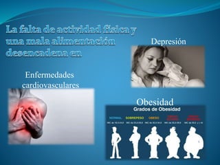 Obesidad
Enfermedades
cardiovasculares
Depresión