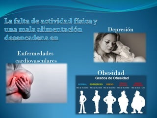 Obesidad
Enfermedades
cardiovasculares
Depresión
 