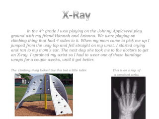 In the 4th grade I was playing on the Johnny Appleseed play
ground with my friend Hannah and Arianna. We were playing on
climbing thing that had 4 sides to it. When my mom came to pick me up I
jumped from the way top and fell straight on my wrist. I started crying
and ran to my mom’s car. The next day she took me to the doctors to get
an X-ray. I sprained my wrist so I had to wear one of those bandage
wraps for a couple weeks, until it got better.

The climbing thing looked like this but a little taller.   This is an x ray of
                                                            a sprained wrist.
 