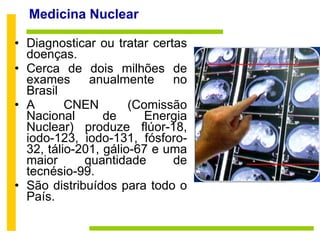 Medicina Nuclear  Diagnosticar ou tratar certas doenças.  Cerca de dois milhões de exames anualmente no Brasil A CNEN (Comissão Nacional de Energia Nuclear) produze flúor-18, iodo-123, iodo-131, fósforo-32, tálio-201, gálio-67 e uma maior quantidade de tecnésio-99. São distribuídos para todo o País. 