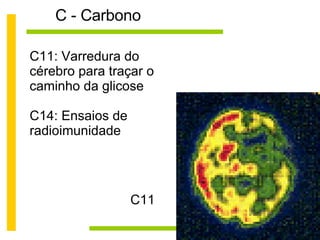 C - Carbono C11 C11: Varredura do cérebro para traçar o caminho da glicose C14: Ensaios de radioimunidade 