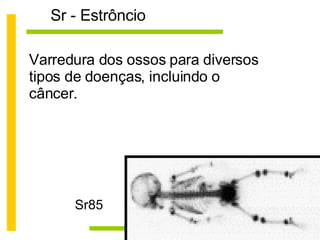 Sr - Estrôncio Sr85 Varredura dos ossos para diversos tipos de doenças, incluindo o câncer. 