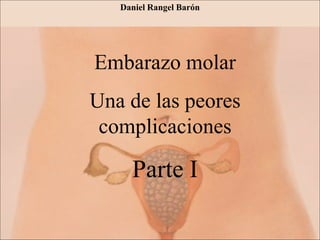 Embarazo molar
Una de las peores
complicaciones
Parte I
Daniel Rangel Barón
 