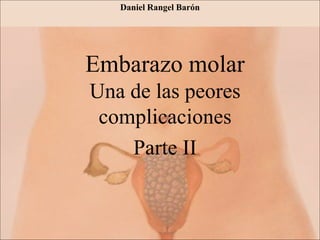 Embarazo molar
Una de las peores
complicaciones
Parte II
Daniel Rangel Barón
 