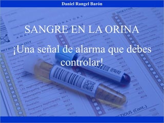 SANGRE EN LA ORINA
¡Una señal de alarma que debes
controlar!
Daniel Rangel Barón
 