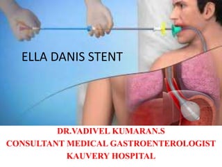 ELLA DANIS STENT
DR.VADIVEL KUMARAN.S
CONSULTANT MEDICAL GASTROENTEROLOGIST
KAUVERY HOSPITAL
 