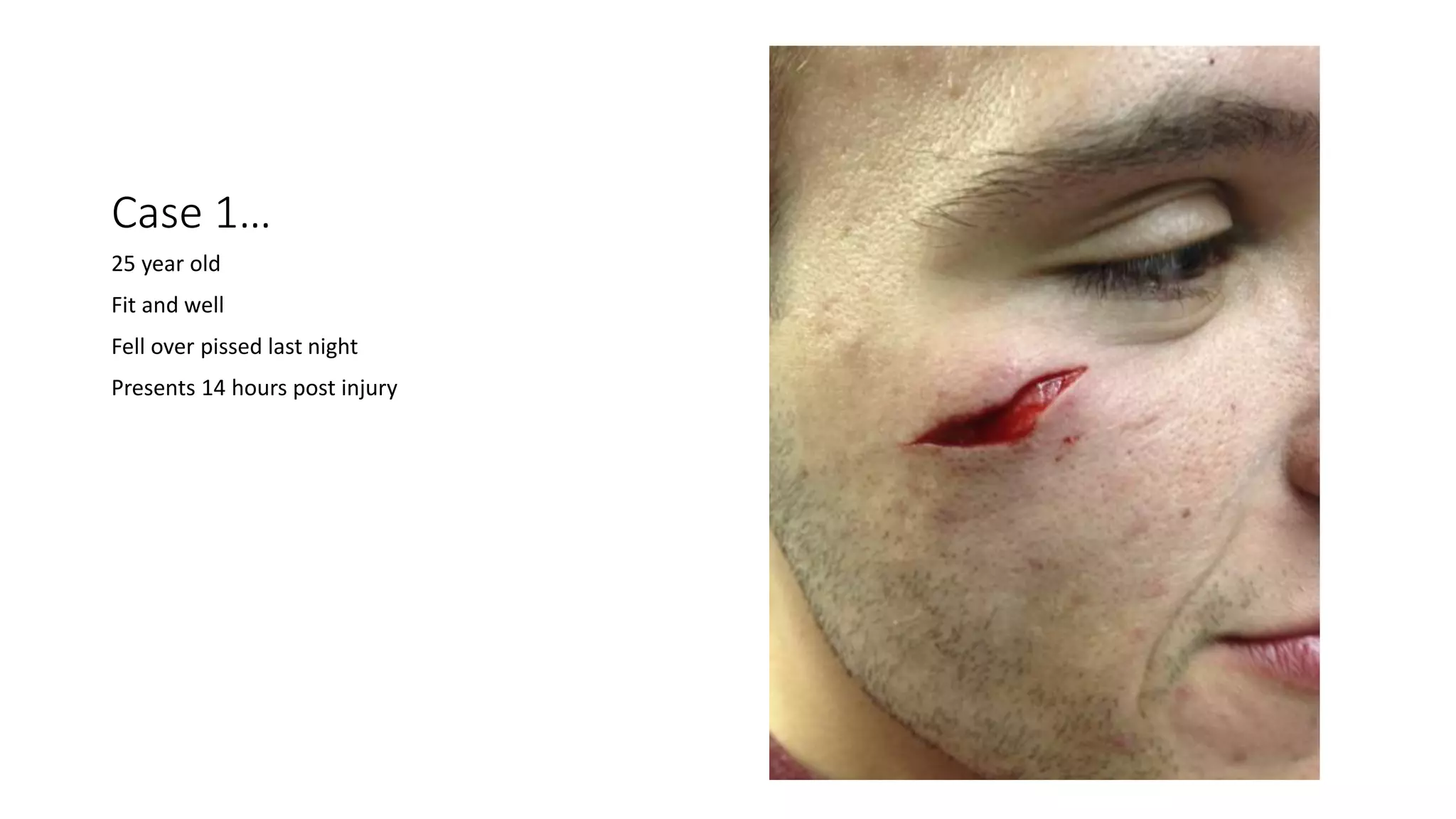 Case 1…
25 year old
Fit and well
Fell over pissed last night
Presents 14 hours post injury
 