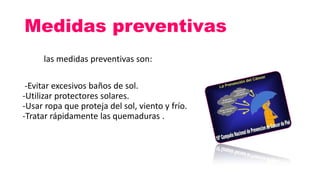Medidas preventivas
las medidas preventivas son:
-Evitar excesivos baños de sol.
-Utilizar protectores solares.
-Usar ropa que proteja del sol, viento y frío.
-Tratar rápidamente las quemaduras .
 