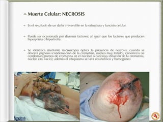 Muerte Celular: NECROSIS
Es el resultado de un daño irreversible en la estructura y función celular.
Puede ser ocasionada por diversos factores; al igual que los factores que producen
hiperplasia o hipertroﬁa.
Se identiﬁca mediante microscopia óptica la presencia de necrosis, cuando se
observa pignosis (condensación de la cromatina, núcleo muy teñido), cariorrecis (se
condensan grumos de cromatina en el núcleo) o cariolisis (dilución de la cromatina,
núcleo casi vacío); además el citoplasma se vera eosinoﬁlico y homogeneo

 