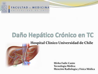 Hospital Clínico Universidad de Chile
Mirko Fadic Canto
Tecnología Médica
Mención Radiología y Física Médica
 