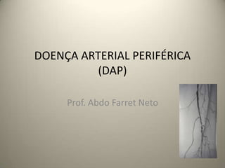 DOENÇA ARTERIAL PERIFÉRICA
          (DAP)

     Prof. Abdo Farret Neto
 