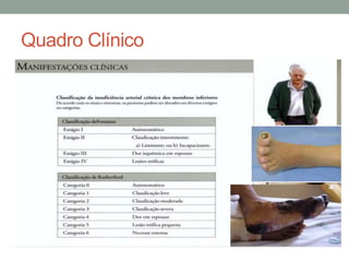 Quadro Clínico
 