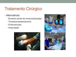 Tratamento Cirúrgico
• Alternativas:
• Enxerto/ ponte de revascularização;
• Tromboendarterectomia;
• Endovascular;
• Amputação
 