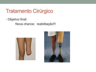 Tratamento Cirúrgico
• Objetivo final:
Nova chance: reabilitação!!!
 