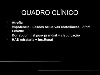 QUADRO CLÍNICO
QUADRO CLÍNICO
•
Atrofia
•
Impotência : Lesões oclusivas aortoiliacas . Sind.
Leriche
•
Dor abdominal pos- prandial + claudicação
•
HAS refrataria + Ins.Renal
 