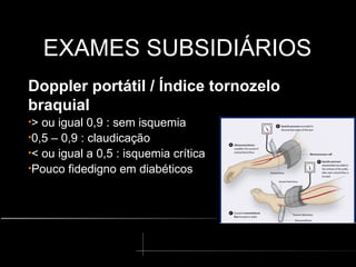 EXAMES SUBSIDIÁRIOS
EXAMES SUBSIDIÁRIOS
Doppler portátil / Índice tornozelo
braquial
•> ou igual 0,9 : sem isquemia
•0,5 – 0,9 : claudicação
•< ou igual a 0,5 : isquemia crítica
•Pouco fidedigno em diabéticos
 