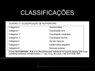 CLASSIFICAÇÕES
CLASSIFICAÇÕES
 