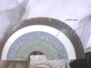 CUERPO CILIAR
IRIS
 